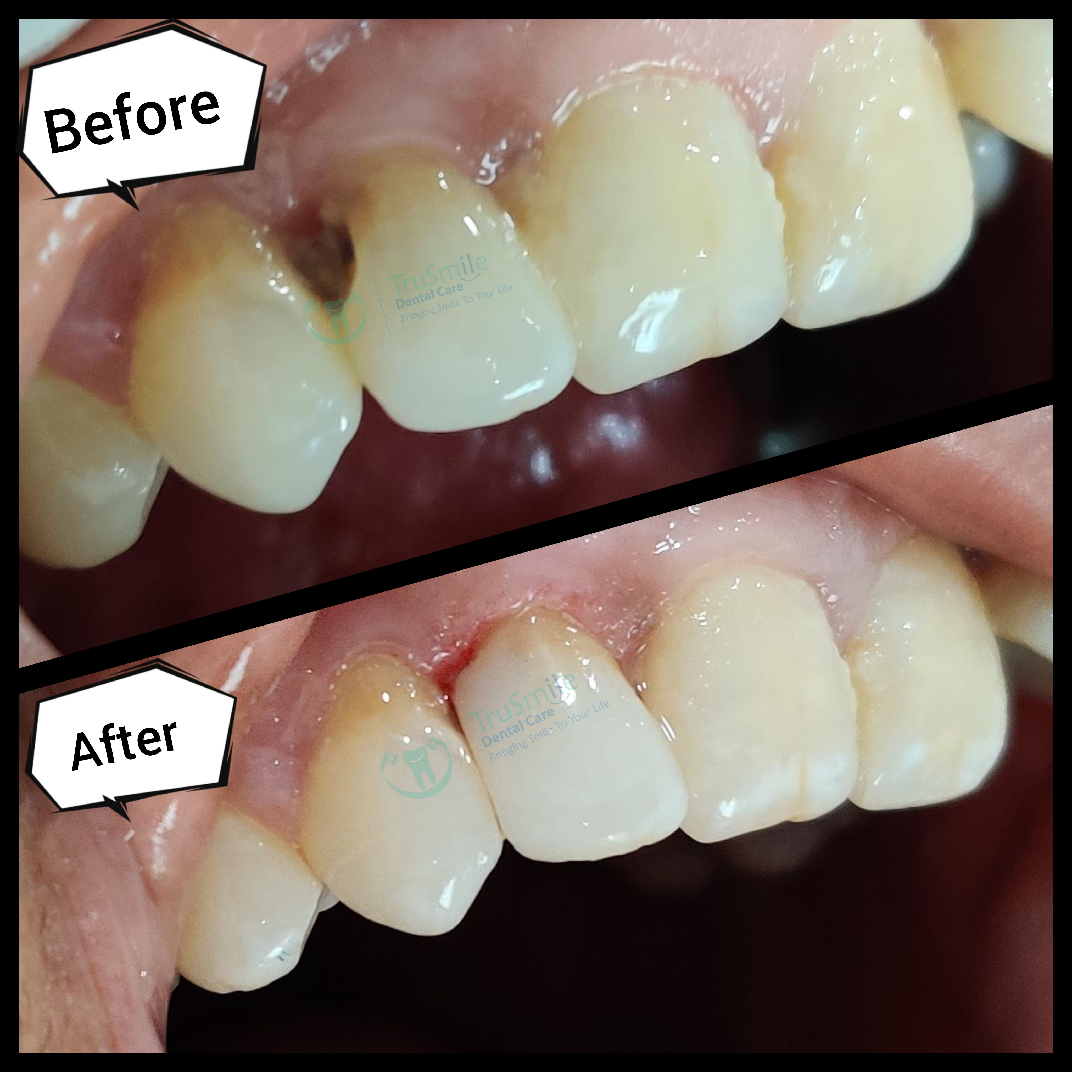 Composite 7